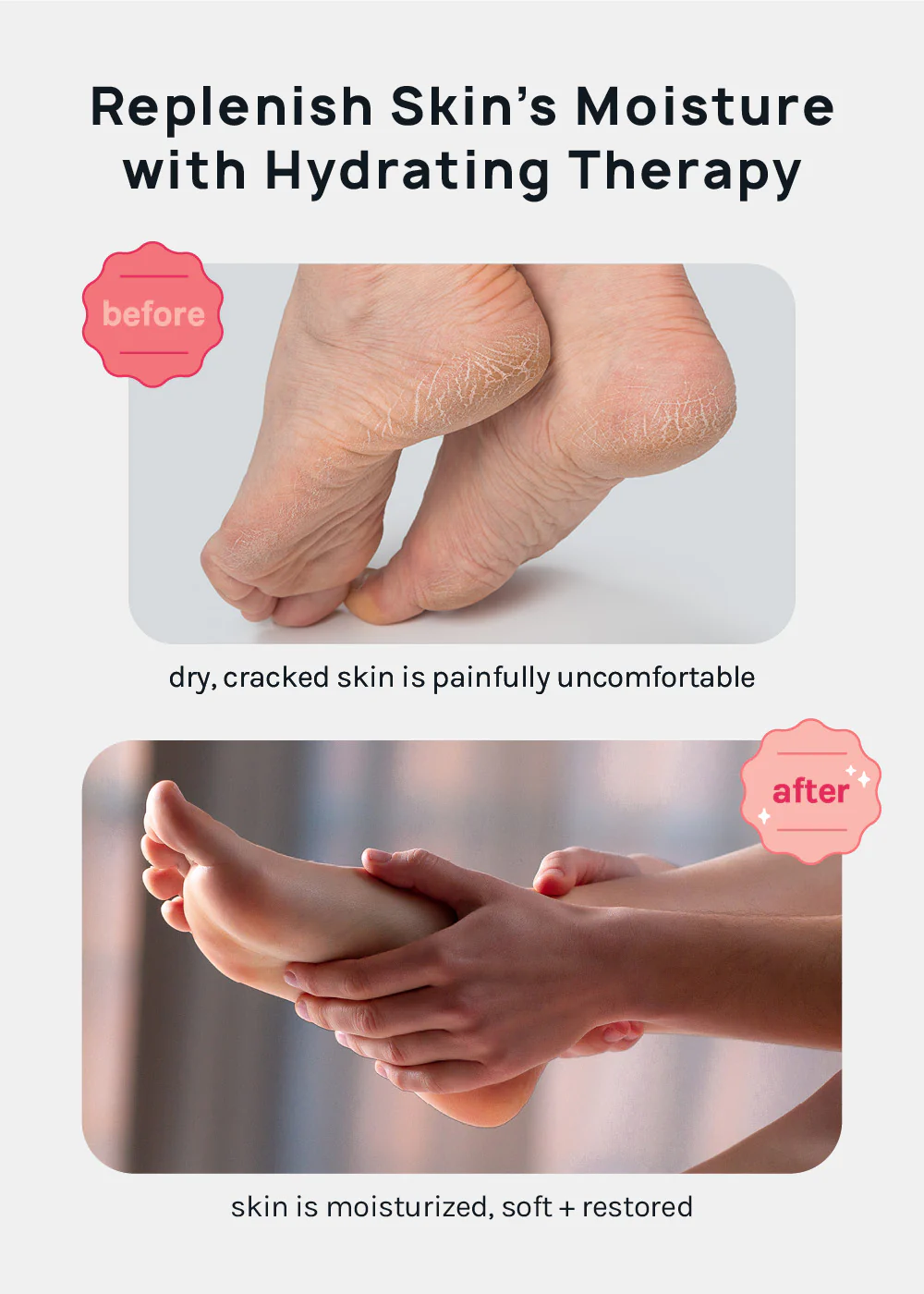 A+ Gel Lined Moisturizing Spa Sock - Image 2
