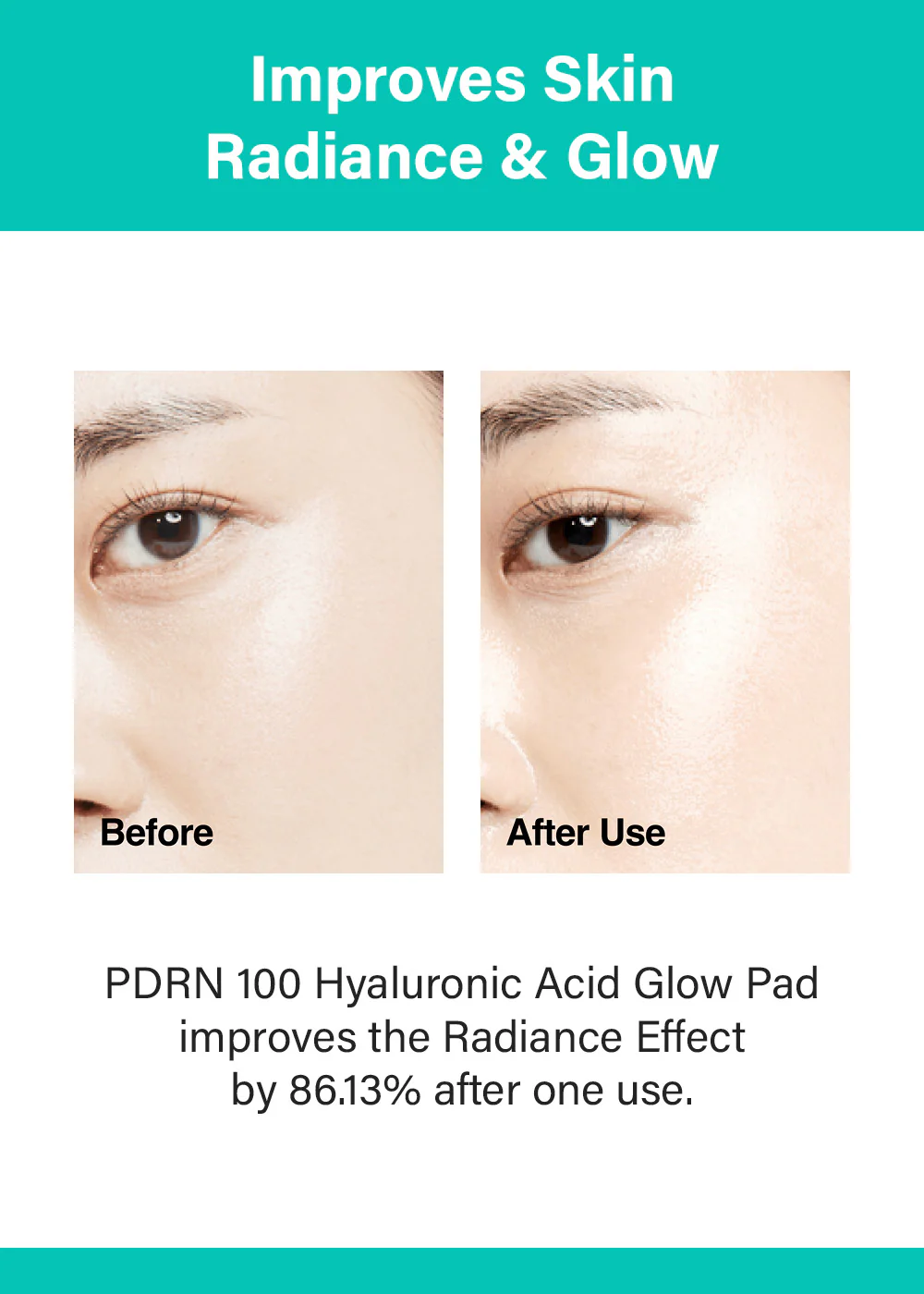 Anua PDRN 100 Hyaluronic Acid Glow Pad (60 Pads) - Image 3