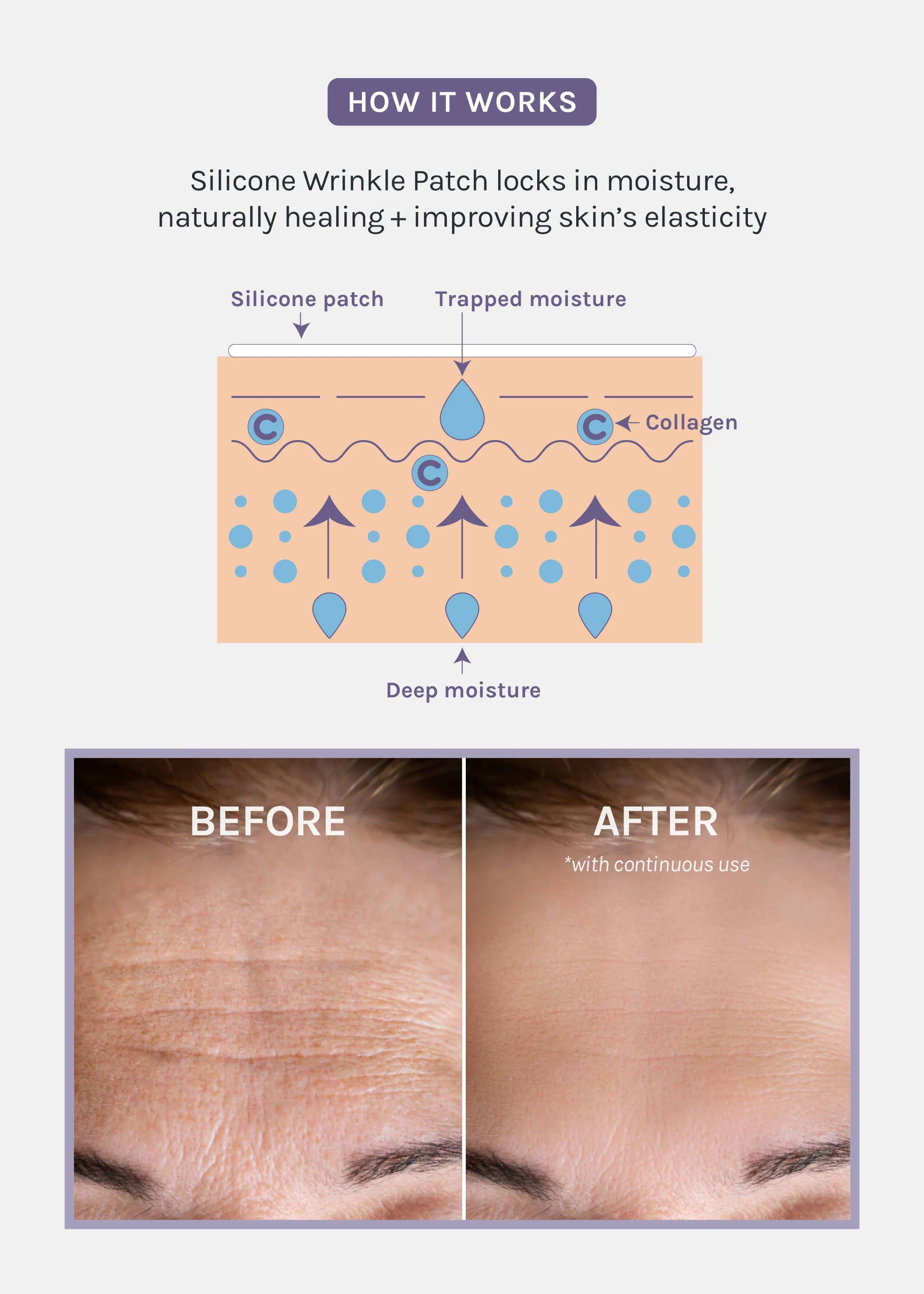 AOA Skin Wrinkle Smoothing Patch – Forehead - Image 4