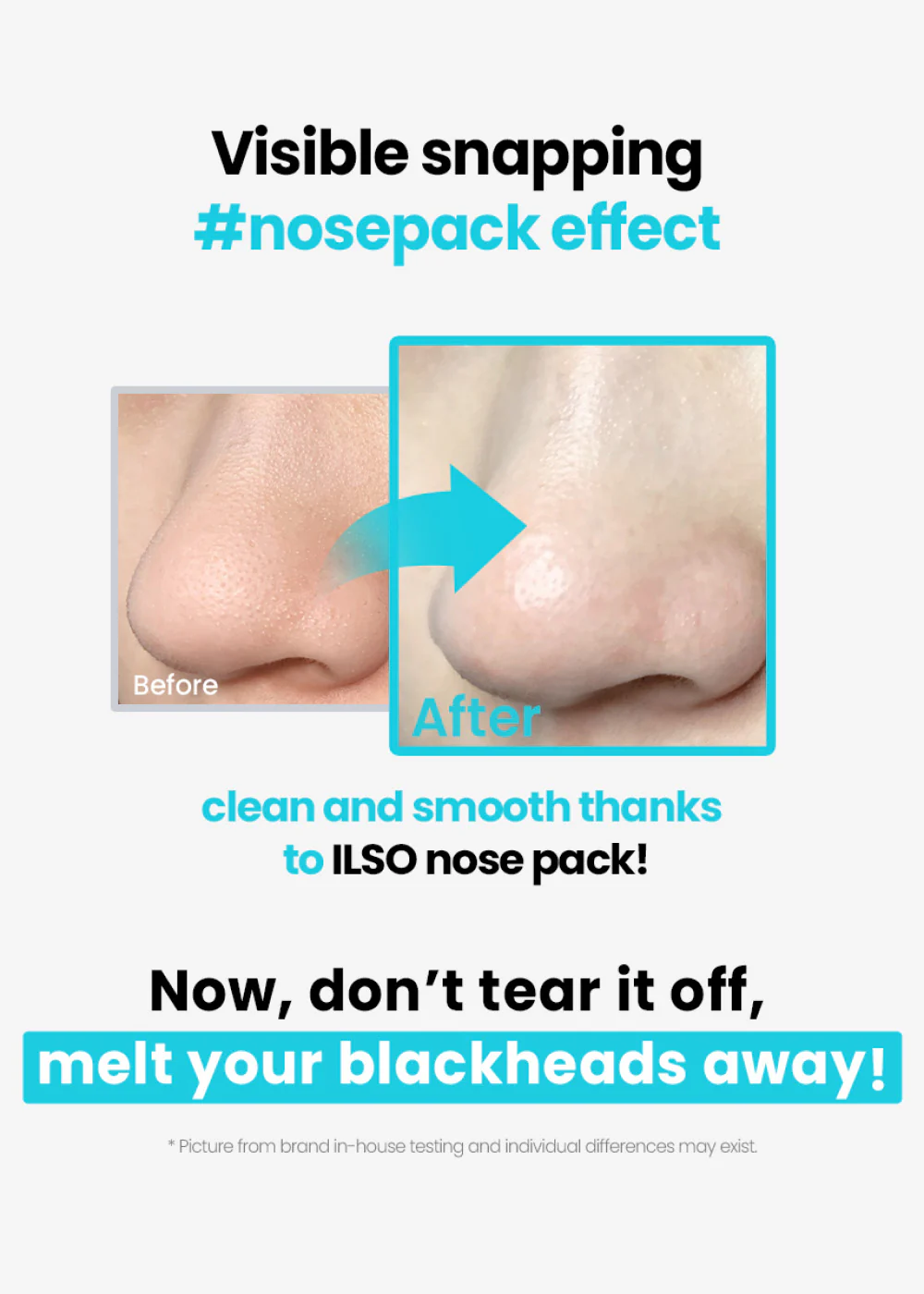 ilso Natural Mild Clear Nose Pack - Image 2